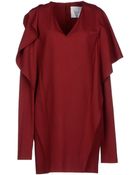 Normaluisa Short Dress - Lyst