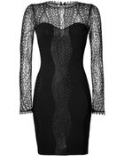 Emilio Pucci Lace Top Dress in Black - Lyst