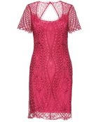 Emilio Pucci Lace Dress - Lyst