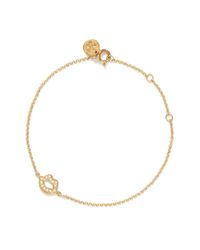 Carat* | Metallic Urban Lips Chelsea Bracelet | Lyst